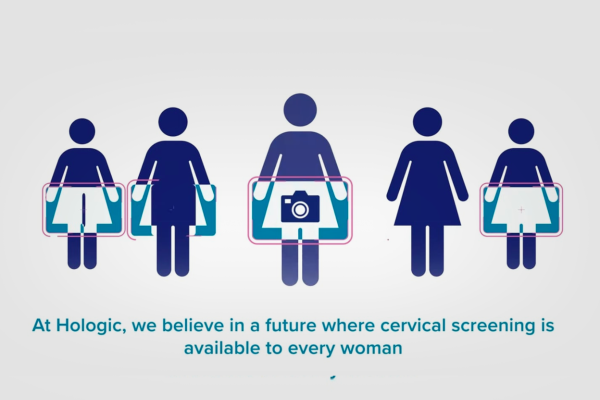 infographic image showing cervical screening view of women