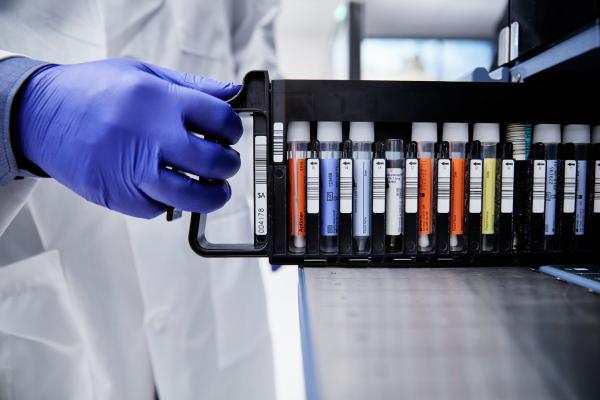 PCR tests in a rack held by a hand wearing gloves