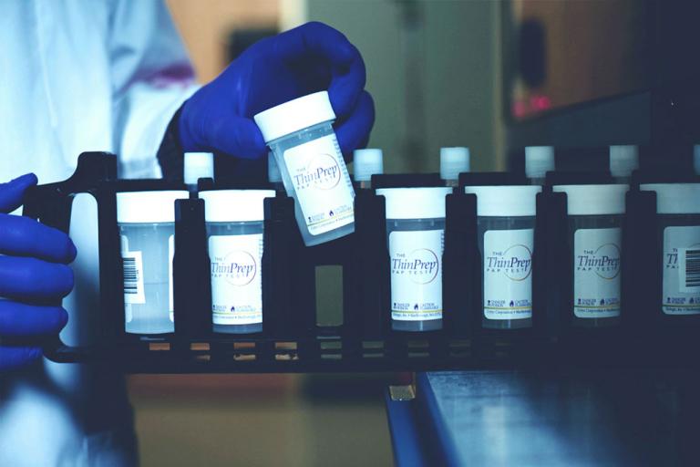 Person handling Thinprep collection vials on tray