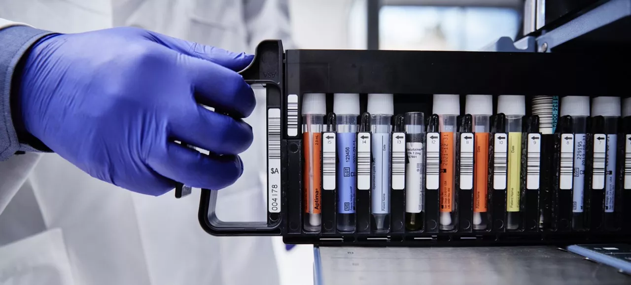 PCR tests in a rack held by a hand wearing gloves