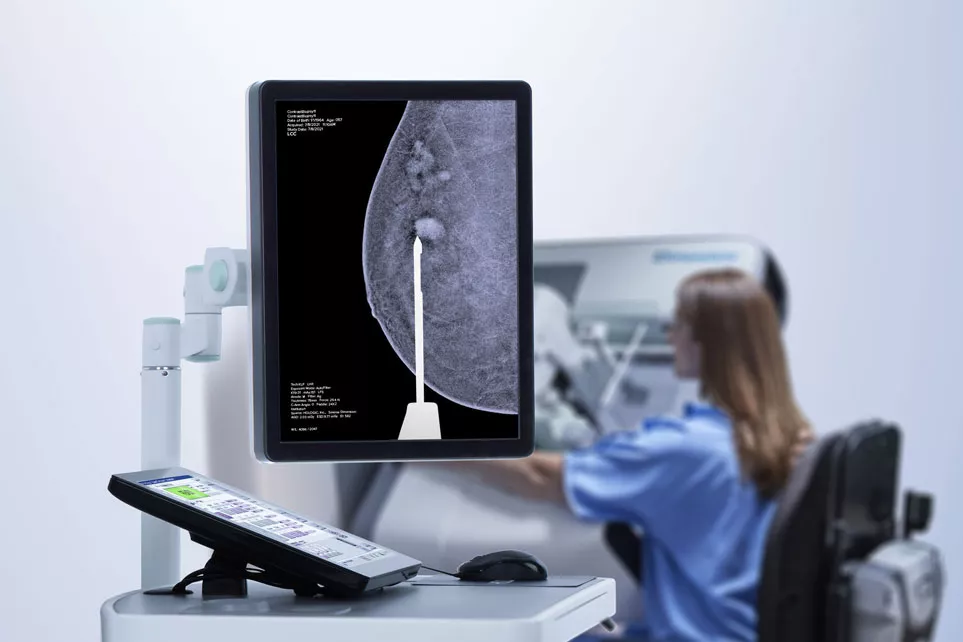 3D contrast mammography on a computer screen