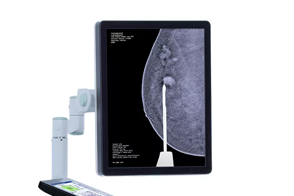 3D contrast mammography on a computer screen