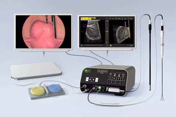 Medical instrument and monitors on a white background.