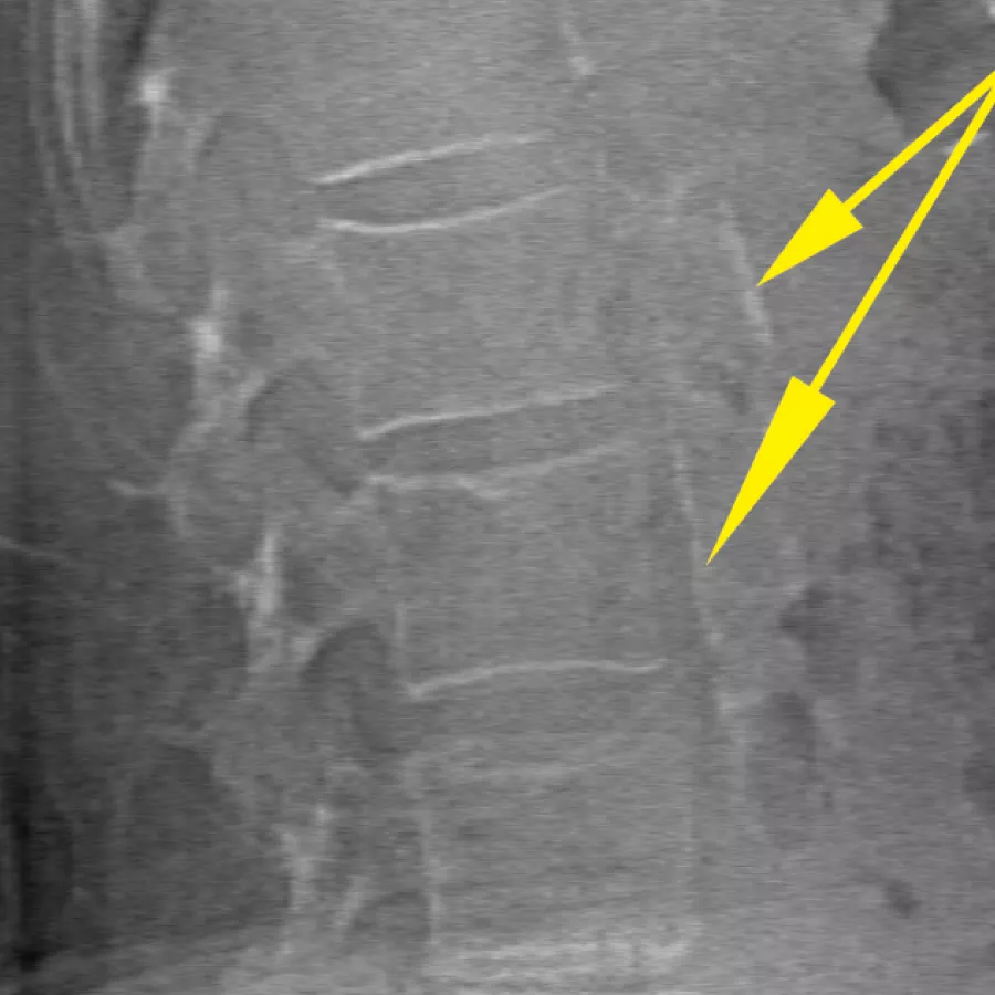 BMD & Bone Imaging with arrow pointing to potential issues